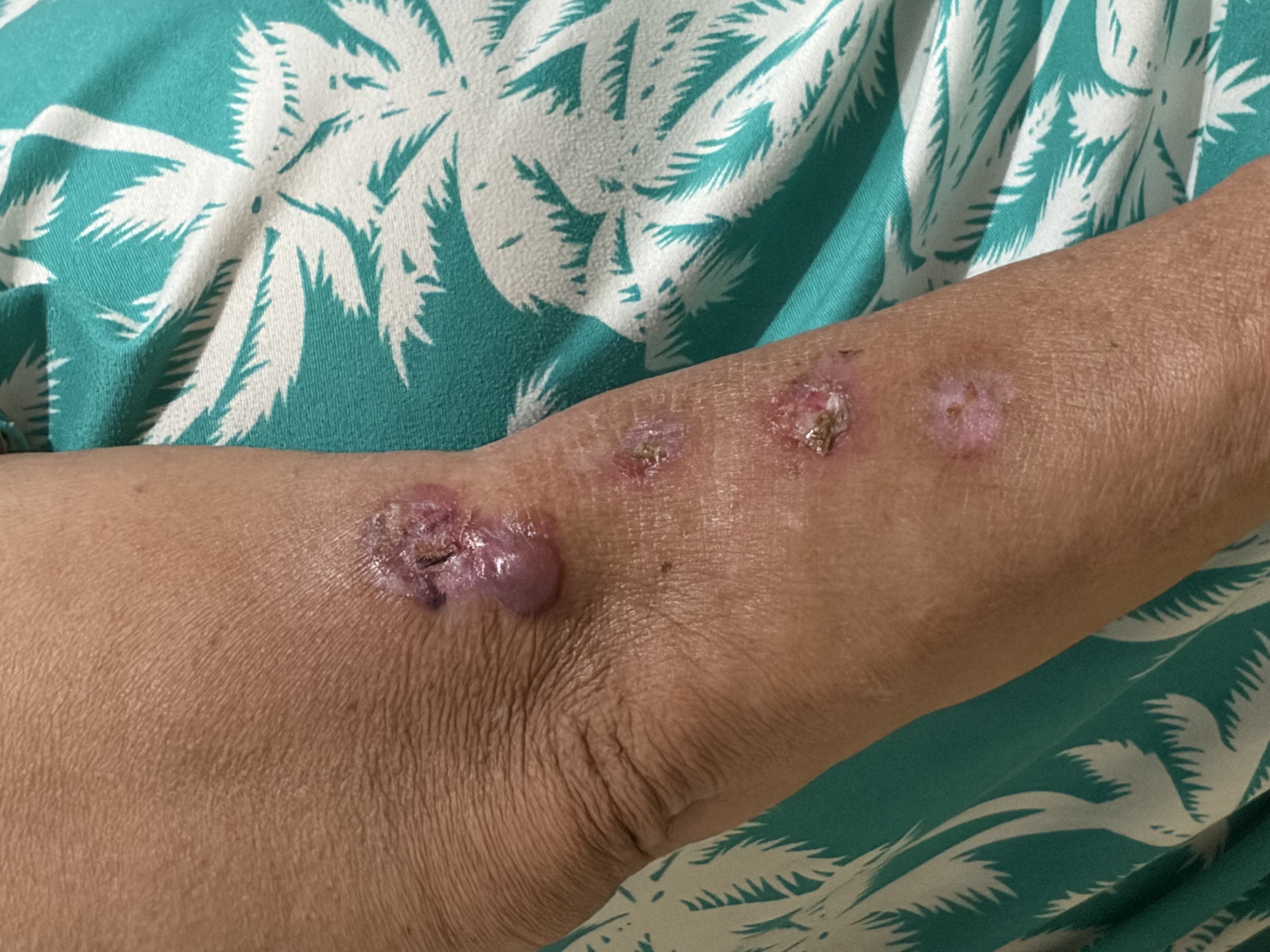     Support My Mom’s Fight for Recovery