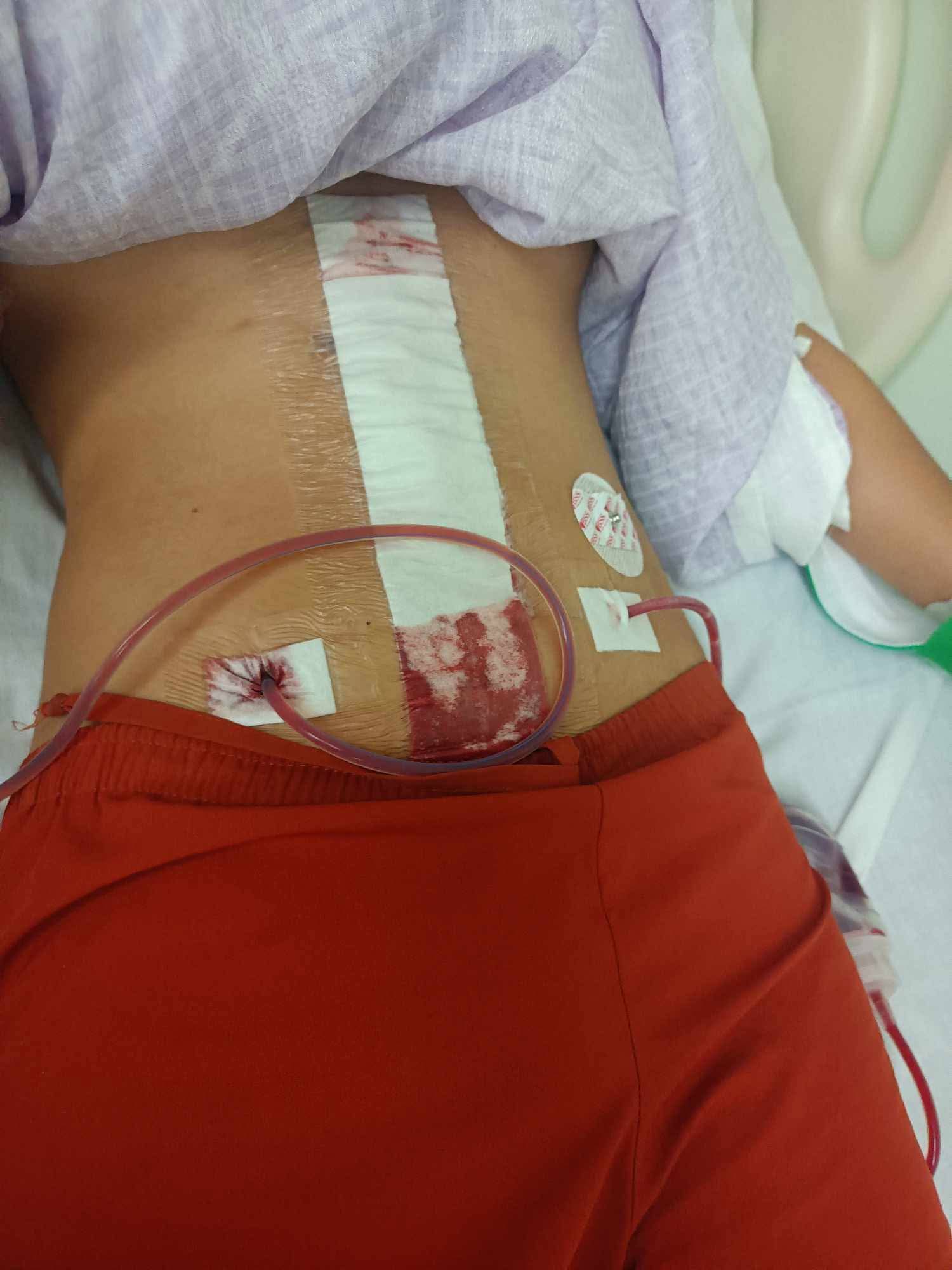 Relief Fund for Shaine's Ongoing Care