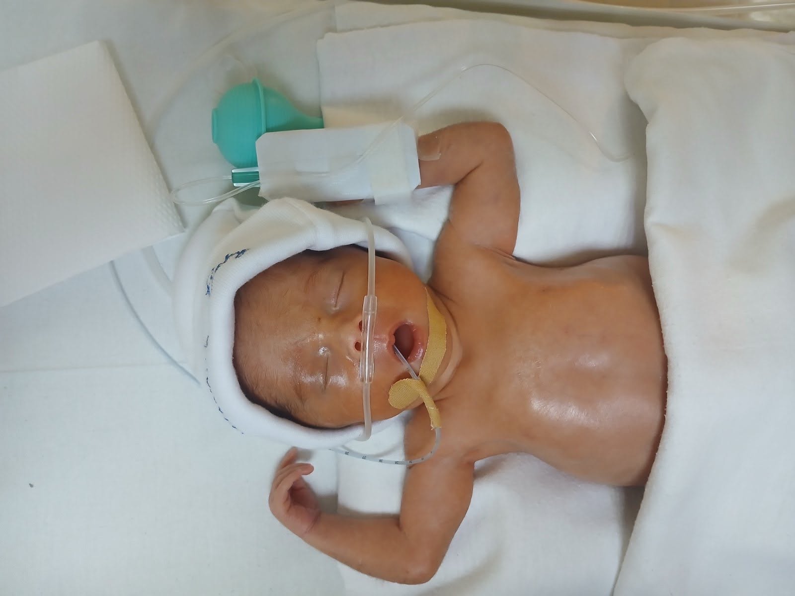 Our Little Fighter, NatNat: Help Us Bring Him Home