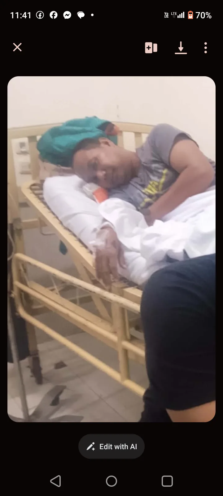 For Emergency ercp and laparoscopic cholecystectomy operation